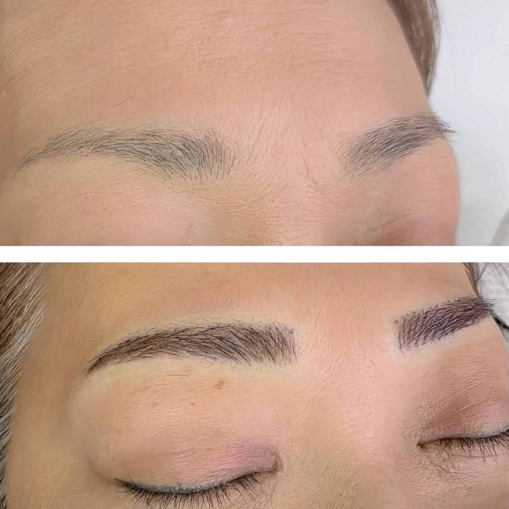 眉毛のアートメイクの症例写真