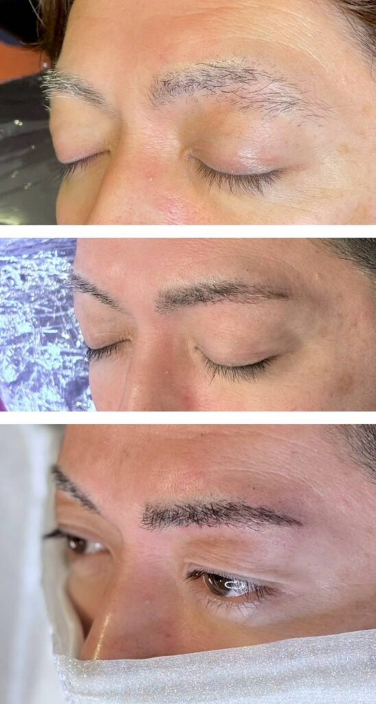 眉毛アートメイク ｜薬院駅から徒歩6分の内科・小児科・美容皮膚科の