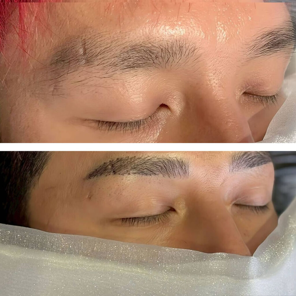 眉毛のアートメイクを受けた男性の症例写真