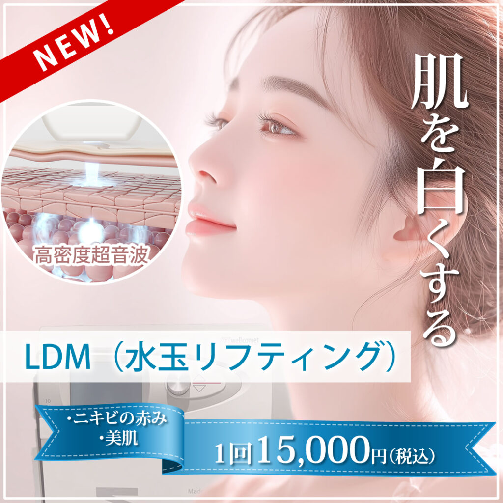 LDMのバナー